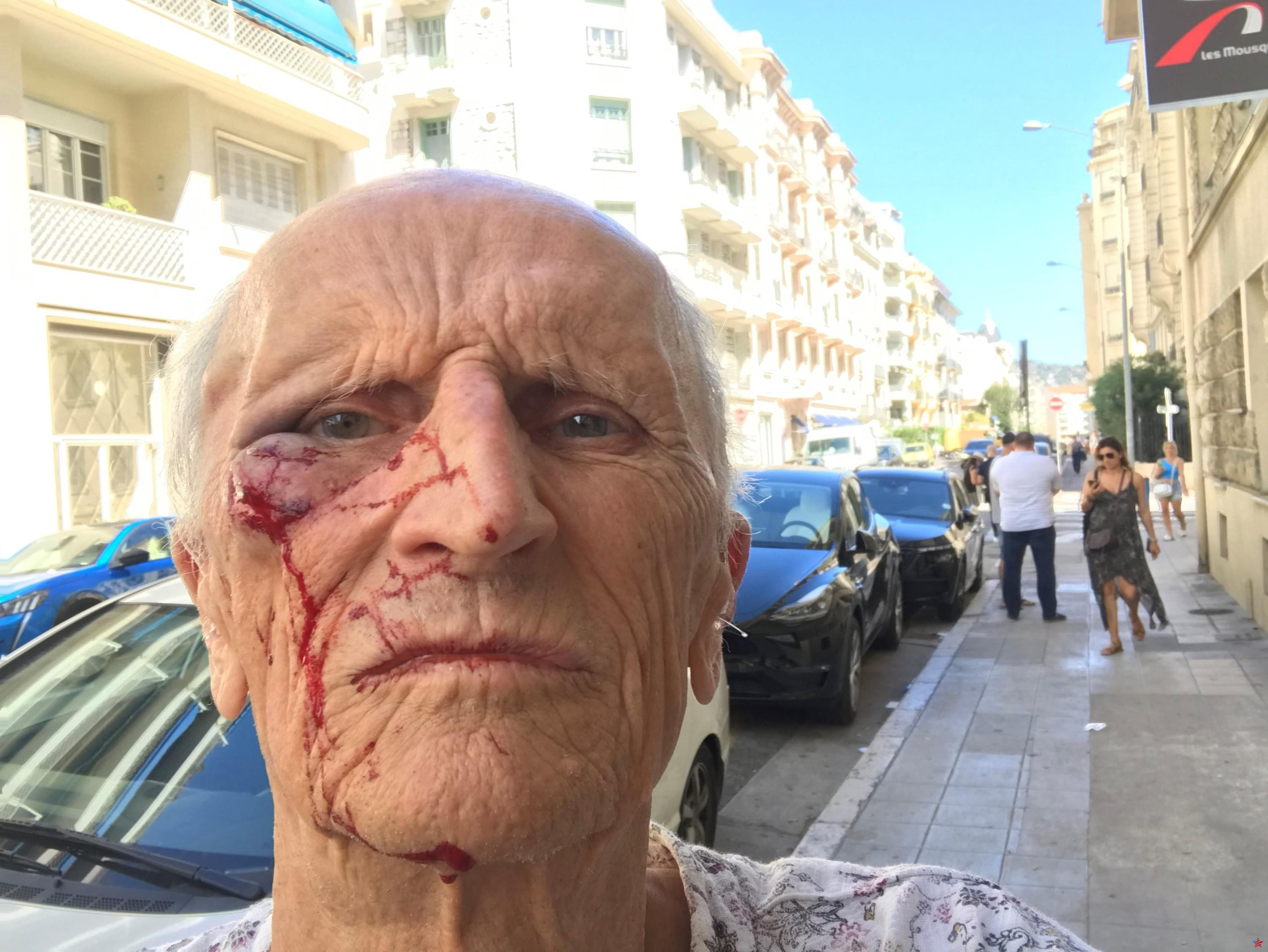 Médico de 80 años atacado violentamente en Niza: el acusado condenado a seis meses de prisión